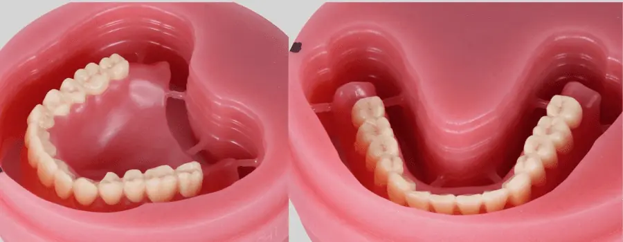 Two molds in wich are two dentures made with a 3d print